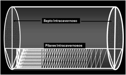 
							Esquema del triángulo que se forma entre los pilares
								intracavernosos y el tabique intercavernoso del pene
						