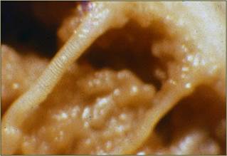 
							Foto macroscópica de los pilares intracavernosos del pene
						