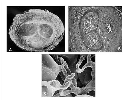 
							Cuerpos cavernosos del pene
						