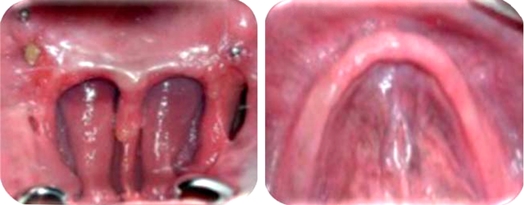 
							Initial intraoral photographs.
						