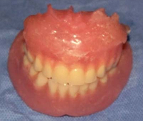 
							Completed dentures.
						