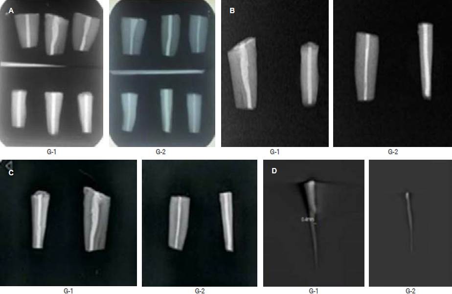 Root Scan Body Evaluation of density obturation in principal root canal with ...