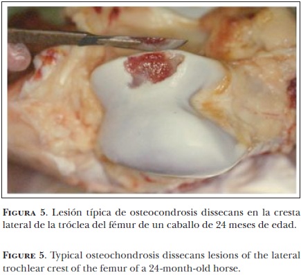 osteochondrosis l4